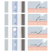 Aparelho de Limpeza Facial Ultrassónico 4 em 1 Falnik InnovaGoods Anticelulíticos - nacloset 2