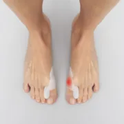 Corretor-protetor de silicone para joanetes Bunilief   Pack de 2 uds Black Friday - nacloset